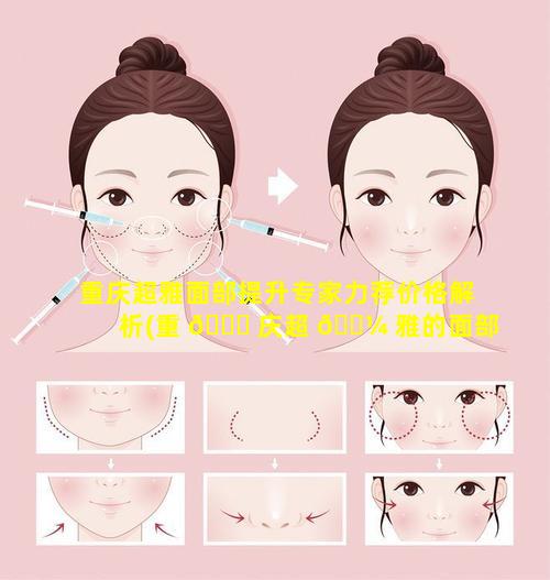 重庆超雅面部提升专家力荐价格解析(重 🍁 庆超 🌼 雅的面部提升怎么样)